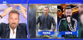 Francesco Facchinetti, la battaglia contro la calvizie: "Ho trovato la pace con una patch cutanea" Francesco Facchinetti, la battaglia contro la calvizie: "Ho trovato la pace con una patch cutanea"