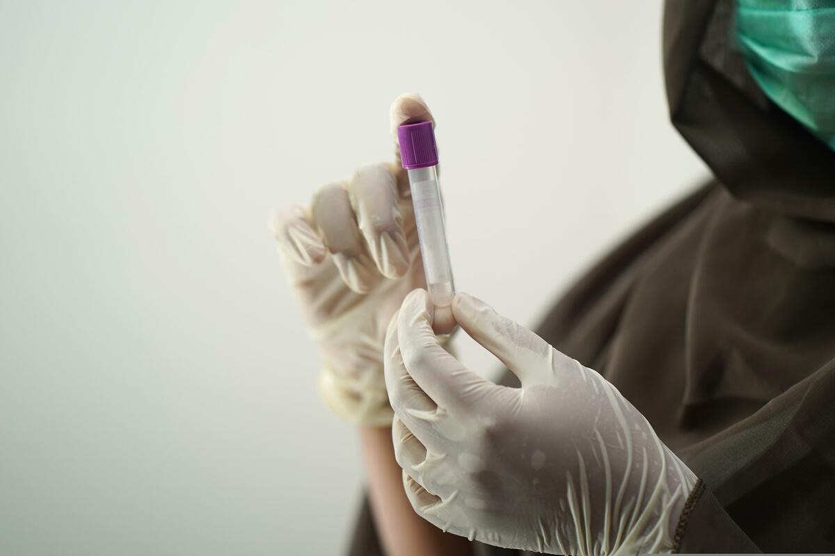 Hantavirus, la Regione invia la circolare del Ministero della Salute ad aziende sanitarie e personale medico