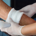 Infortunio sul lavoro a Masserano: si infilza l'avambraccio con una forbice