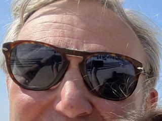 Elsa Rubino lotta per la vita, papà Lorenzo: "Grazie ai biellesi per esserci così vicini"