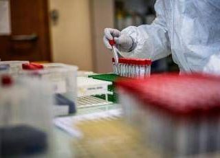 Covid Italia, avanza variante Stratus: tornano i 'vecchi' sintomi Covid Italia, avanza variante Stratus: tornano i 'vecchi' sintomi