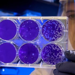 Coronavirus Piemonte, eseguiti i primi 6.064 test sugli operatori sanitari regionali