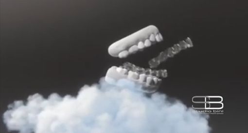 Dal Dott. Valerio Bini scopri cosa può fare l'ortodonzia trasparente per il tuo allineamento dentale estetico VIDEO