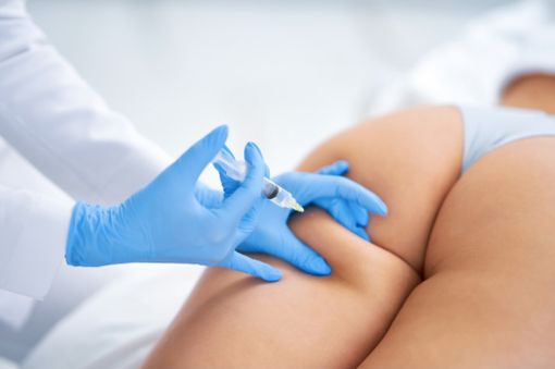 Il dialogo con la bellezza di Beauty Med: ridurre il grasso in eccesso con la Mesoterapia Lipolitica