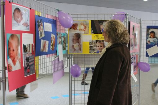 I bambini prematuri che ce l'hanno fatta, le loro foto prima e dopo all'Ospedale