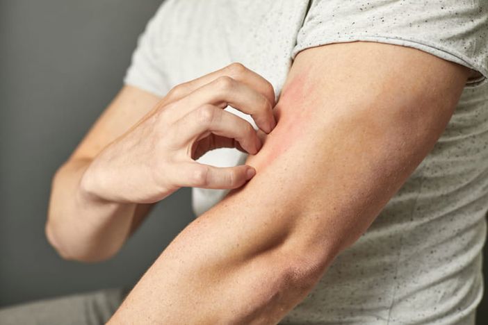 Il prurito: cause, sintomi e trattamenti