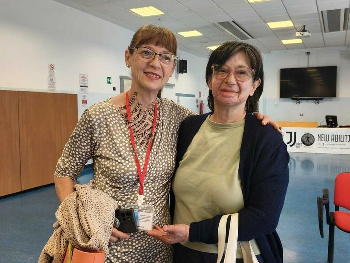 Ustionata da una fiammata, fa la volontaria al CTO: "Ho incontrato Elsa, era sorridente" Ustionata da una fiammata, fa la volontaria al CTO: "Ho incontrato Elsa, era sorridente"