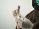 Hantavirus, la Regione invia la circolare del Ministero della Salute ad aziende sanitarie e personale medico (foto di repertorio)