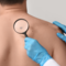 Giornata Europea del Melanoma: le linee guida per la prevenzione Giornata Europea del Melanoma: le linee guida per la prevenzione