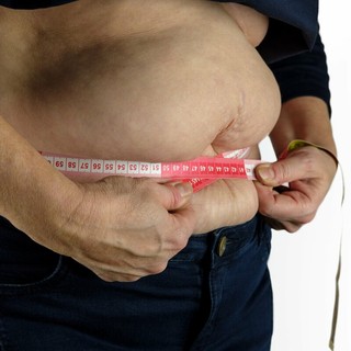 Obesità, anche nel Biellese il peso è un problema: "Lo stile di vita ha un ruolo particolarmente importante"