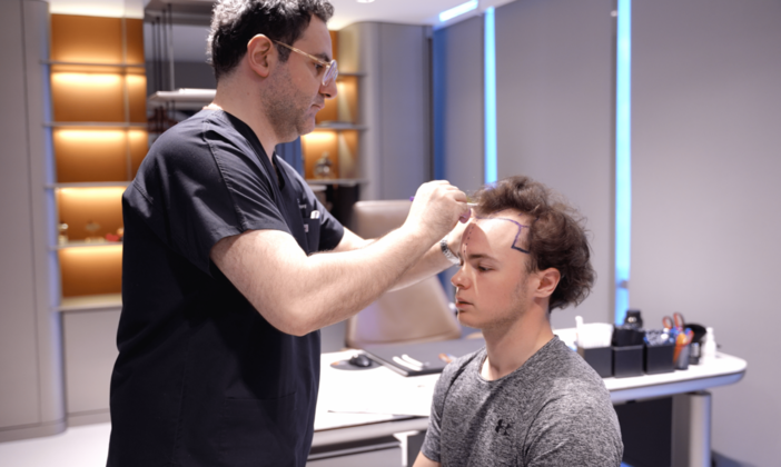 Il Dr. Levent Acar: considerato internazionalmente il più noto chirurgo per il trapianto di capelli in Turchia