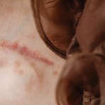 Lite a Cossato, donna cade e resta ferita a una gamba, foto pexels