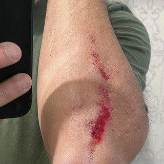 Runner rischia di essere travolto da un'auto, il racconto: “Ho rischiato la vita”