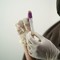Hantavirus, la Regione invia la circolare del Ministero della Salute ad aziende sanitarie e personale medico (foto di repertorio) Hantavirus, la Regione invia la circolare del Ministero della Salute ad aziende sanitarie e personale medico (foto di repertorio)