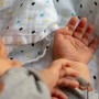Giornata Internazionale delle Ostetriche, Nursing Up: "L’esodo tocca livelli record: 1.700 dimissioni dal pubblico nel biennio 2024-2025"