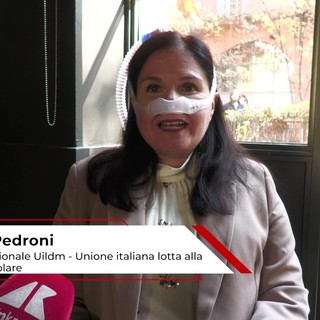 Sma: Pedroni (Uildm), 'risdiplam compresse libera tempo per vivere' Sma: Pedroni (Uildm), 'risdiplam compresse libera tempo per vivere'