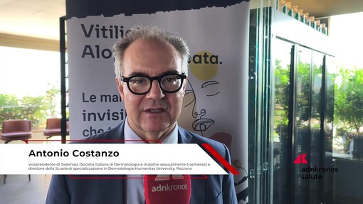 Farmaci: Costanzo (Sidemast), 'attendiamo ok Aifa per nuova cura per vitiligine e alopecia'