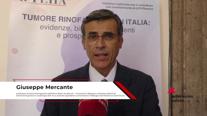 Tumore rinofaringeo, otorinolaringoiatra Mercante: "Gioco di squadra migliora prognosi paziente"