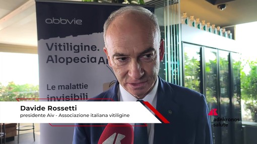 Salute: Rossetti (Aiv), 'associazione per accelerare riconoscimento nuove terapie vitiligine'