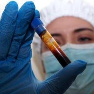 Hantavirus, negativo il turista inglese in quarantena a Milano. Test per una donna ricoverata a Messina Hantavirus, negativo il turista inglese in quarantena a Milano. Test per una donna ricoverata a Messina