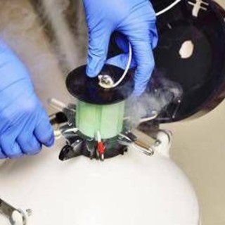 Cancro seno, 1 donna su 4 sceglie la crioconservazione degli ovociti