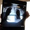 Sirm: "Ai strumento anti liste d'attesa, 50% esami imaging per over70 non necessario"
