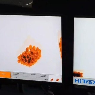 Traffico di eroina a Malpensa, sequestro per 1 milione e 7 arresti