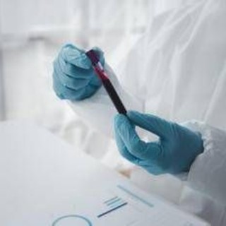 Epatite A in forte crescita in Italia: Lazio, Campania e Puglia le regioni con più casi Epatite A in forte crescita in Italia: Lazio, Campania e Puglia le regioni con più casi