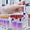 Dal microbiota una speranza contro l'epilessia resistente, lo studio italiano Dal microbiota una speranza contro l'epilessia resistente, lo studio italiano