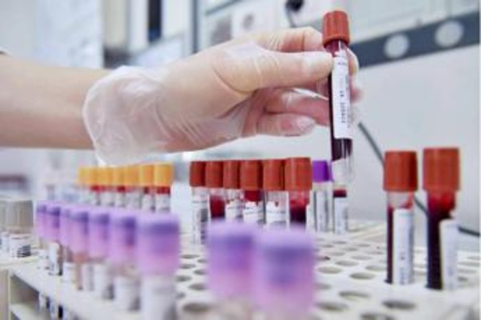 Tumore allo stomaco in stadio precoce, con immunoterapia 69% pazienti vivo a 3 anni Tumore allo stomaco in stadio precoce, con immunoterapia 69% pazienti vivo a 3 anni