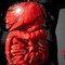 Farmaci, Aifa approva mirikizumab anche nel trattamento della malattia di Crohn Farmaci, Aifa approva mirikizumab anche nel trattamento della malattia di Crohn