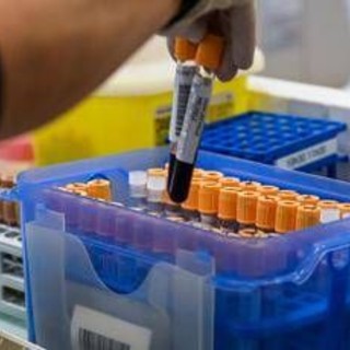 Fegato, un test per scoprire il rischio di gravi malattie entro 10 anni: lo studio Fegato, un test per scoprire il rischio di gravi malattie entro 10 anni: lo studio