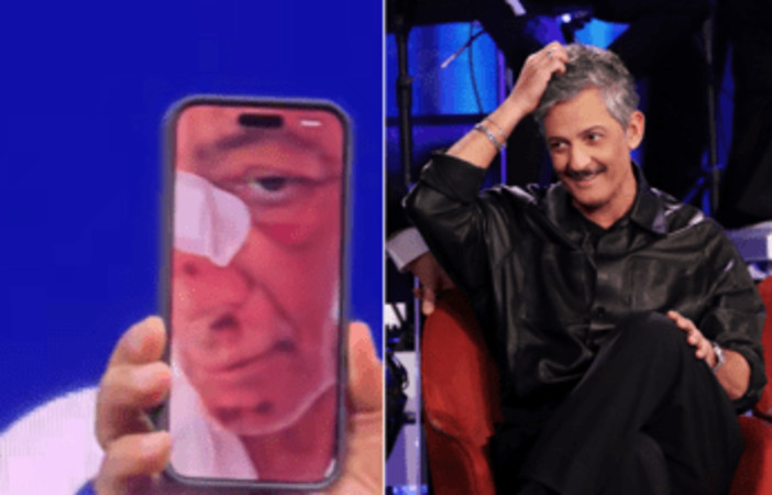 Fiorello, l'incidente in bicicletta: "Volevo fare il figo... sono caduto di faccia" Fiorello, l'incidente in bicicletta: "Volevo fare il figo... sono caduto di faccia"