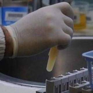 Tre morti per possibile focolaio di infezione da hantavirus su nave da crociera nell'Atlantico﻿