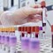 Sclerosi multipla recidivante, Ema raccomanda approvazione ocrelizumab dai 10 anni