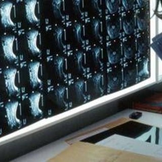 Oltre 500 malattie rare delle ossa, esperti: "Investire in prevenzione e diagnosi" Oltre 500 malattie rare delle ossa, esperti: "Investire in prevenzione e diagnosi"