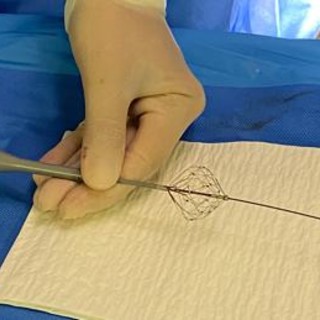 Fibrillazione atriale, Aou Marche: "Prima volta in Italia ablazione con catetere a campo pulsato" Fibrillazione atriale, Aou Marche: "Prima volta in Italia ablazione con catetere a campo pulsato"