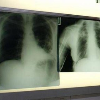 Salute, esperti: "Virus sinciziale sottovalutato nonostante oltre 50mila ricoveri l'anno" Salute, esperti: "Virus sinciziale sottovalutato nonostante oltre 50mila ricoveri l'anno"