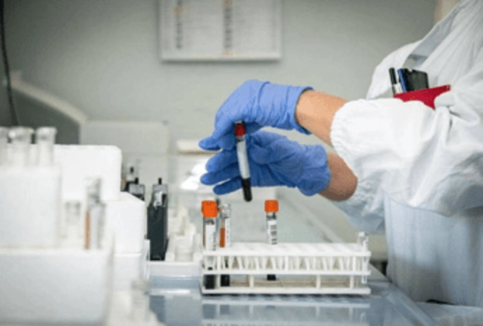 Alzheimer, allo studio nuovo test del sangue per diagnosi precoce Alzheimer, allo studio nuovo test del sangue per diagnosi precoce