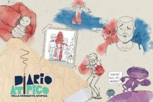 Dermatite atopica, oltre 1,3 mln di persone hanno visto il corto 'Diario atipico' Dermatite atopica, oltre 1,3 mln di persone hanno visto il corto 'Diario atipico'